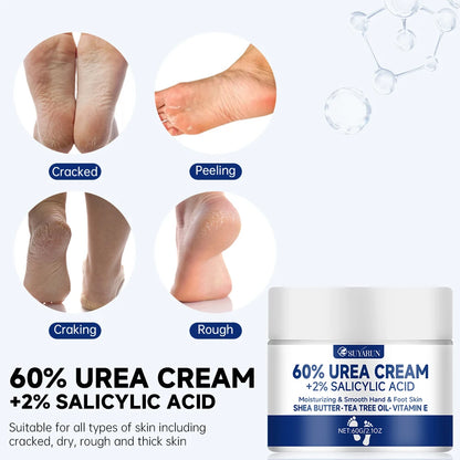 SUYARUN 60% Urea Foot Cream – Intensive Repair for Cracked Heels, Calluses & Dry Skin
