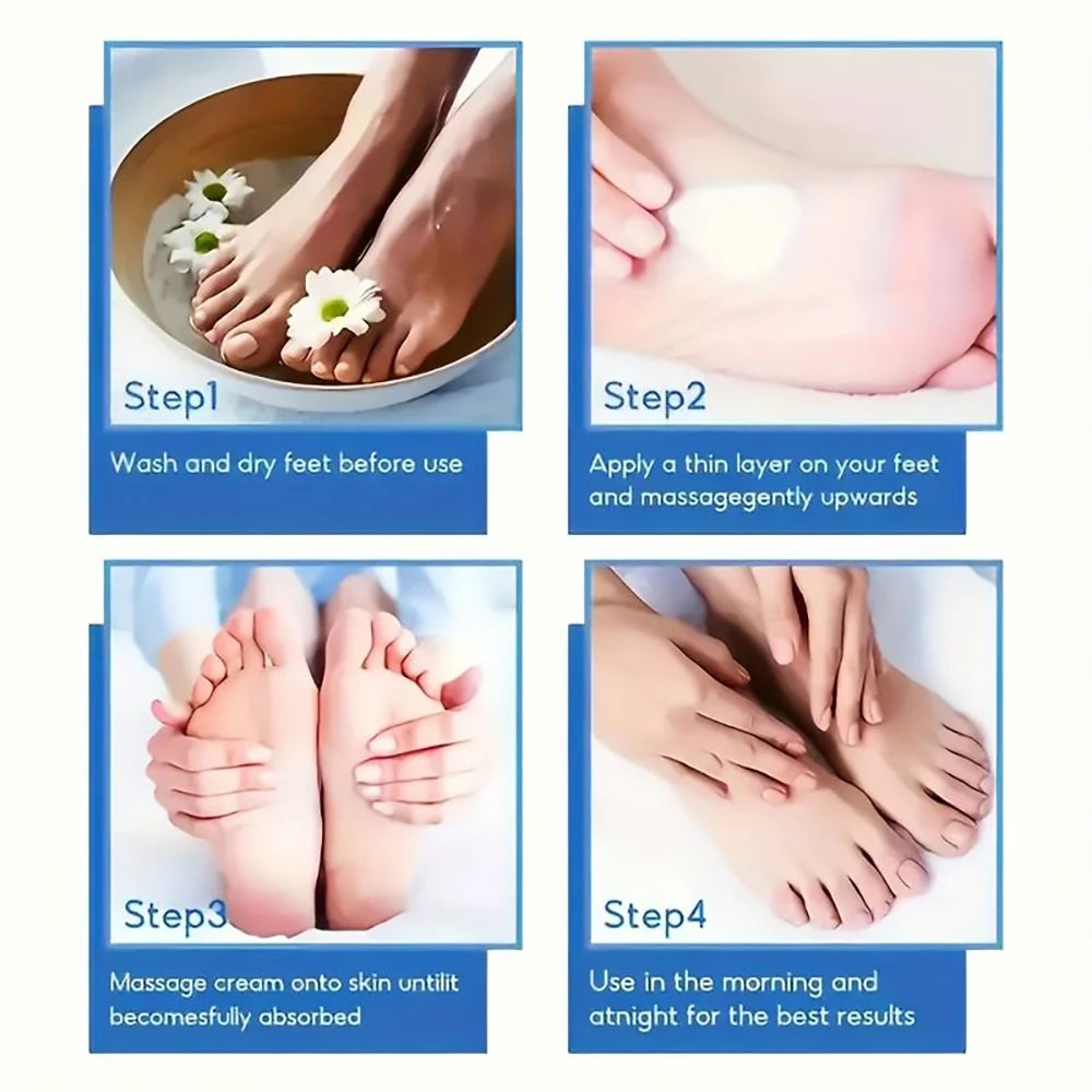 SUYARUN 60% Urea Foot Cream – Intensive Repair for Cracked Heels, Calluses & Dry Skin